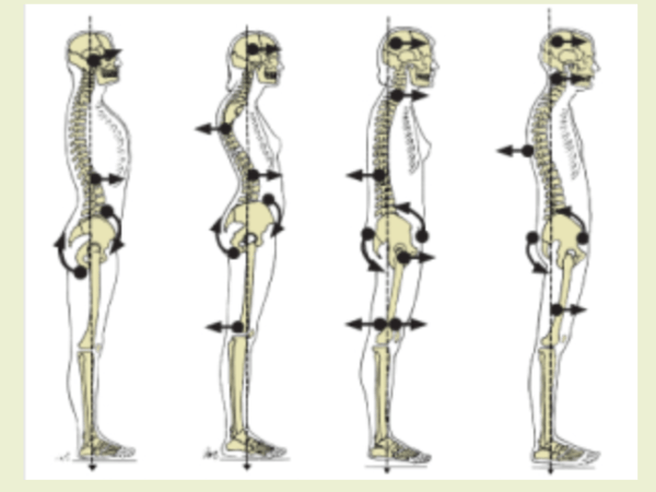 Kilka słów o&nbsp;posturologii